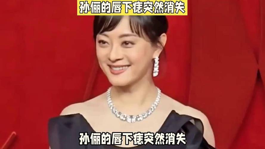 新澳今晚开奖结果查询表34期和孙俪唇下痣没了与孙俪嘴唇的痣